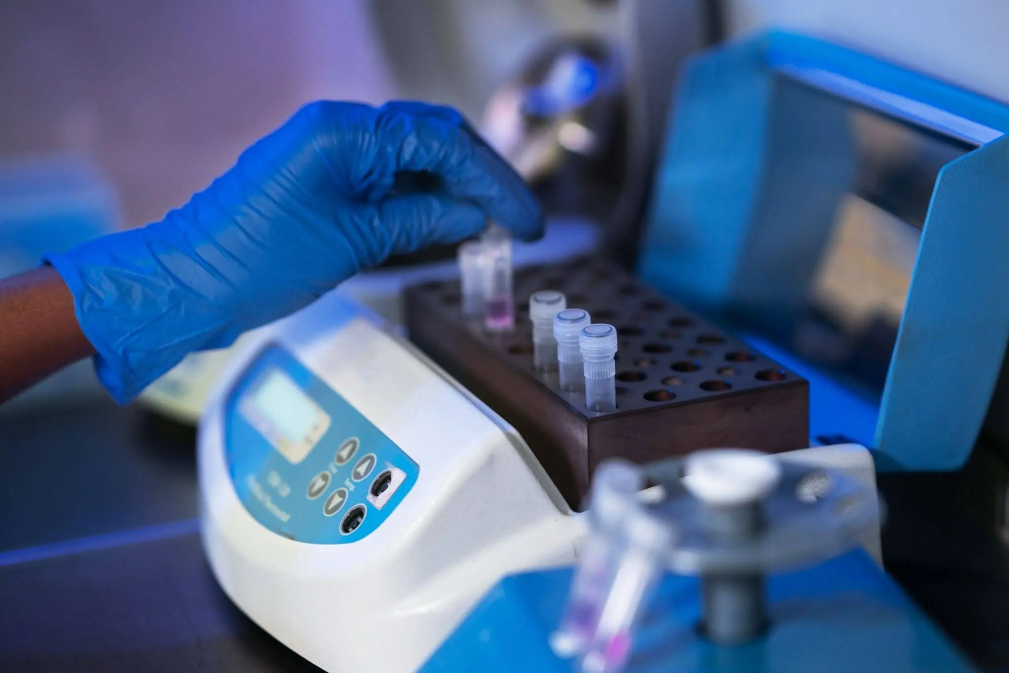 Automated Hematology Analyzer: How It Works, Types & Why It Matters in Modern Labs