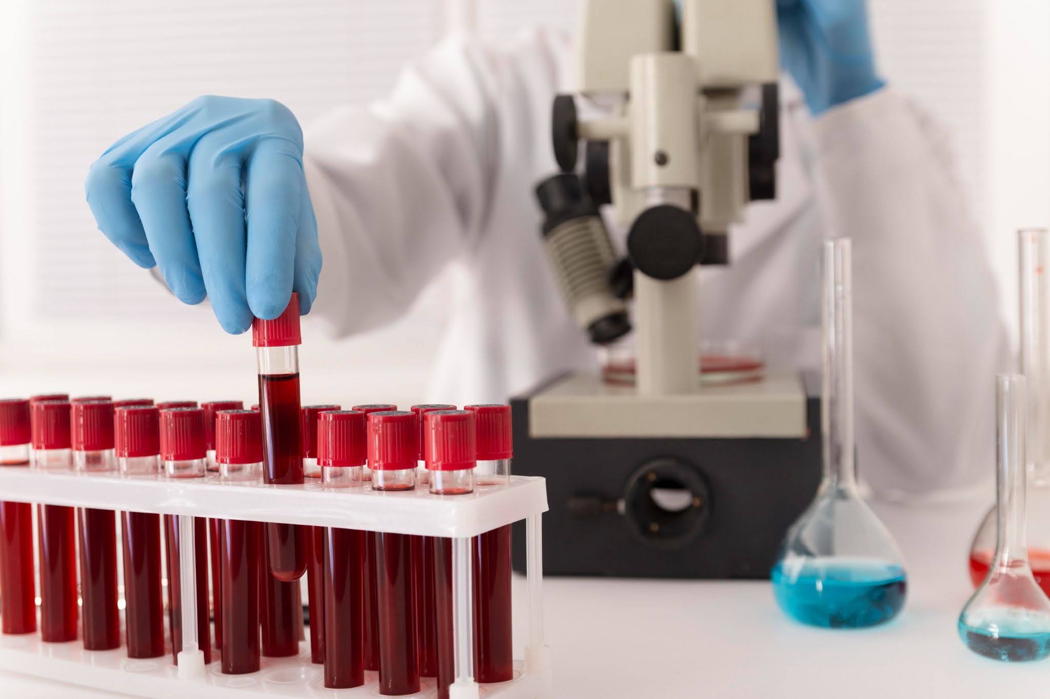 What are 3-Part and 5-Part Hematology Controls